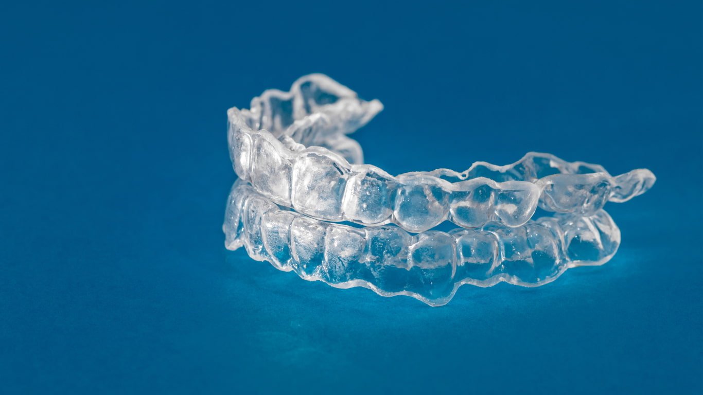 Clear Aligner/Invisalign Kottayam