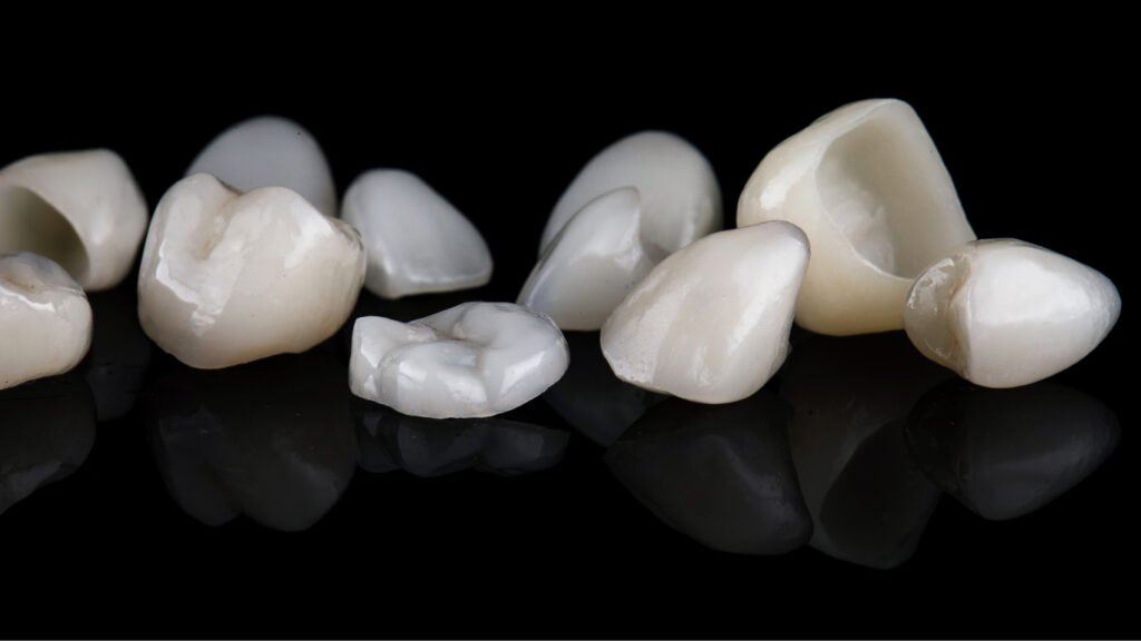 Cosmetic crown Kottayam