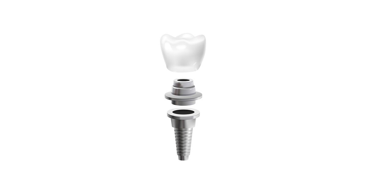 Dental Implants for Seniors: Does Age Really Matter?